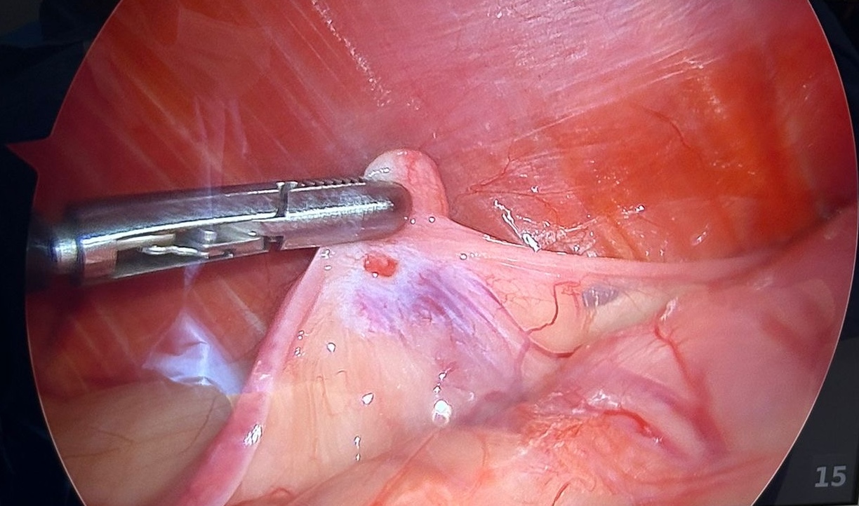 Photo-chirurgie-coelioscopie-camera 2- vWD-chien-